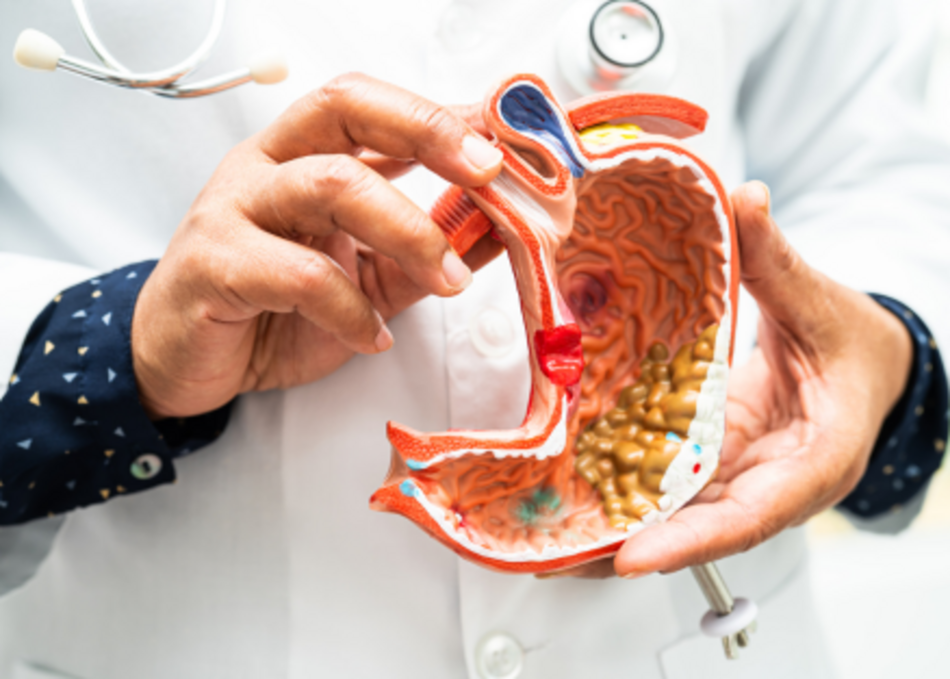 Cancer of Esophagus pancreas, and colon